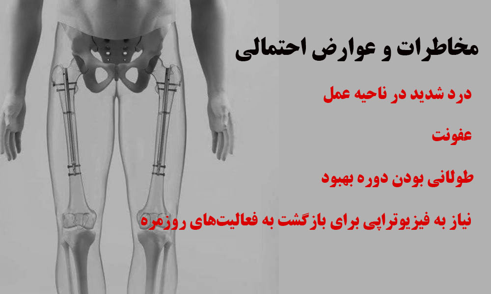 مخاطرات و عوارض احتمالی جراحی افزایش قد