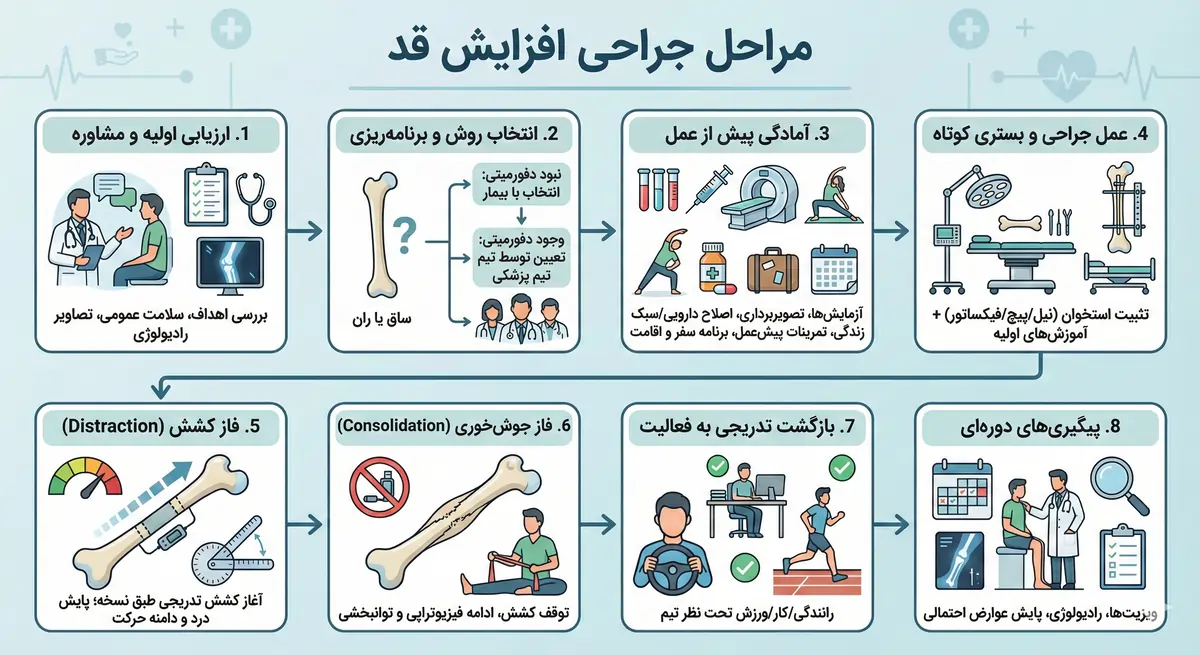 مراحل جراحی افزایش قد مراحل جراحی افزایش قد