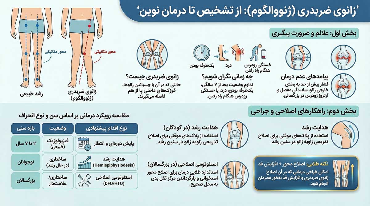 زانوی ضربدری