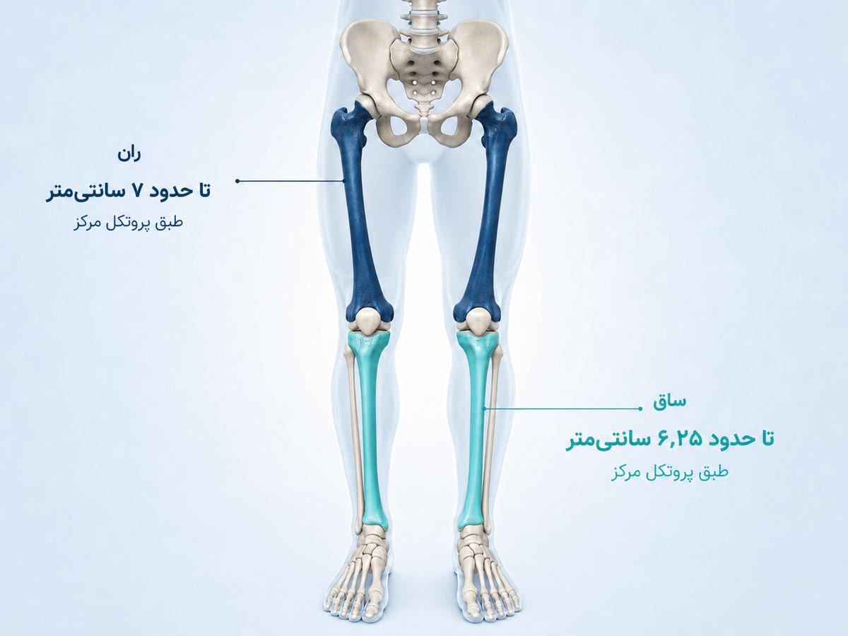 مقایسه افزایش طول استخوان ران و ساق در جراحی افزایش قد