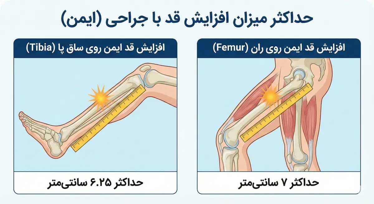 حداکثر میزان افزایش قد ایمن